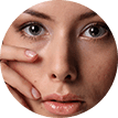 Augenringe